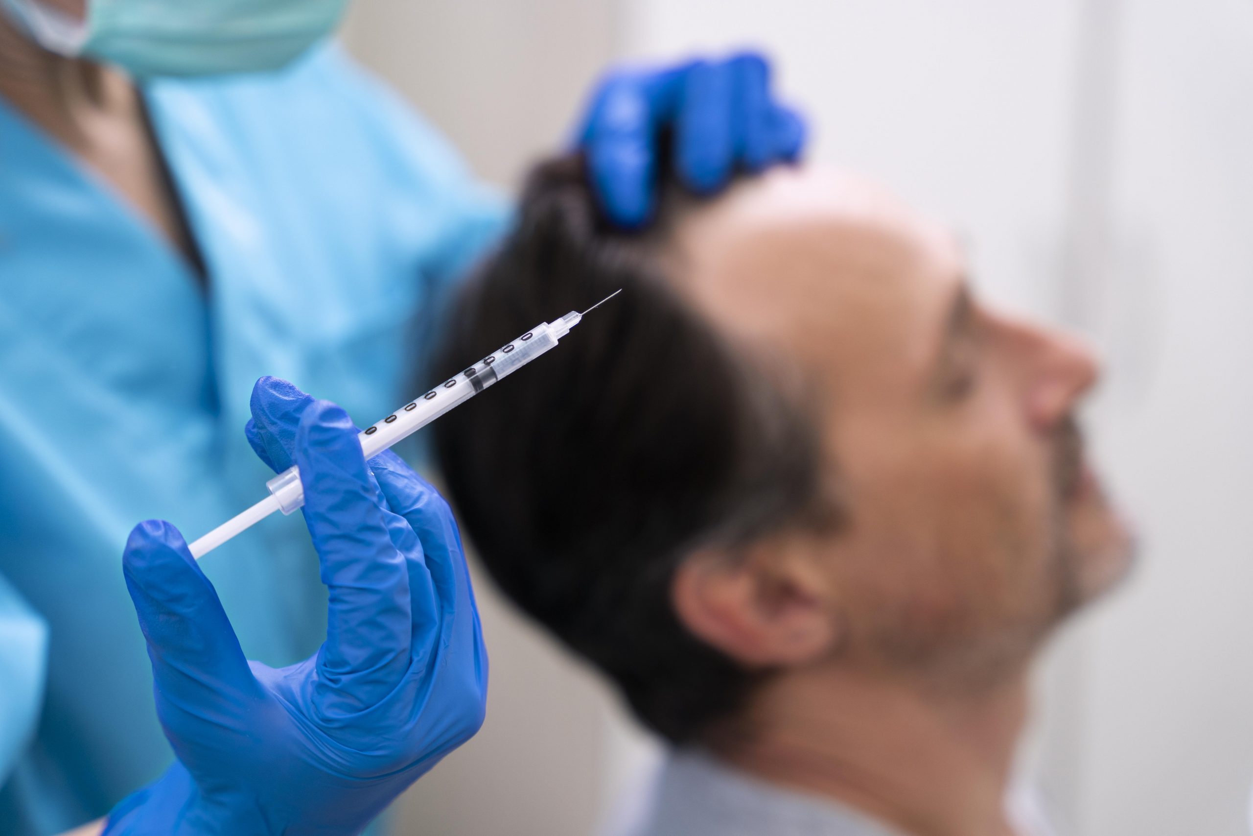man-getting-hair-loss-treatment (1)